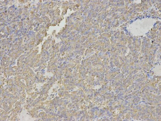 Immunohistochemistry (Formalin/PFA-fixed paraffin-embedded sections) - Anti-HMT antibody (AB196611)