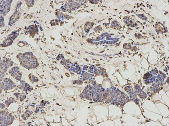 Immunohistochemistry (Formalin/PFA-fixed paraffin-embedded sections) - Anti-HMT antibody (AB196611), expandable thumbnail