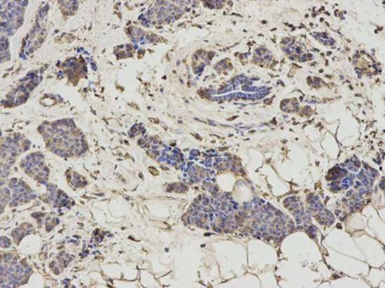 Immunohistochemistry (Formalin/PFA-fixed paraffin-embedded sections) - Anti-HMT antibody (AB196611)
