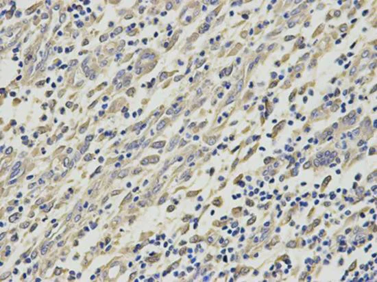 Immunohistochemistry (Formalin/PFA-fixed paraffin-embedded sections) - Anti-HMT antibody (AB196611)