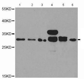 Western blot - Anti-HMT antibody (AB196611), expandable thumbnail
