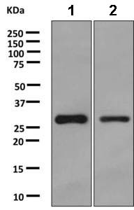 Western blot - Anti-HMT antibody [EPR8311] (AB166609), expandable thumbnail