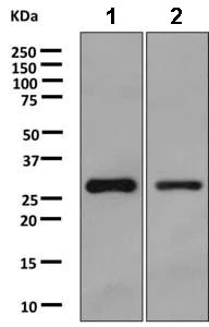 Western blot - Anti-HMT antibody [EPR8311] (AB166609)