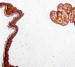 Immunohistochemistry (Formalin/PFA-fixed paraffin-embedded sections) - Anti-HMW Cytokeratin antibody [34bE12] (AB776)
