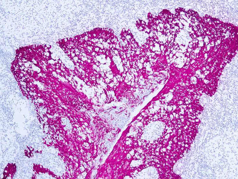 Immunohistochemistry (Formalin/PFA-fixed paraffin-embedded sections) - Anti-HMW Cytokeratin antibody [34bE12] (AB776)