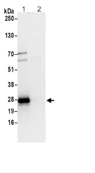 Immunoprecipitation - Anti-HN1L/L11 antibody (AB200571)