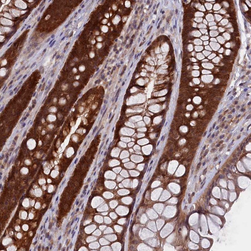 Immunohistochemistry (Formalin/PFA-fixed paraffin-embedded sections) - Anti-HN1L/L11 antibody (AB247030), expandable thumbnail
