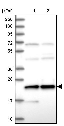 Western blot - Anti-HN1L/L11 antibody (AB247030), expandable thumbnail