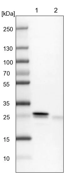 Western blot - Anti-HN1L/L11 antibody (AB247030)