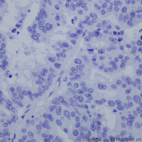 Immunohistochemistry (Formalin/PFA-fixed paraffin-embedded sections) - Anti-HNF-1B antibody [EPR18644-13] (AB213149)