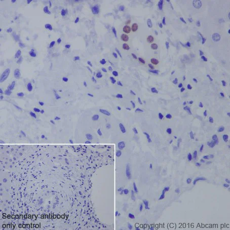 Immunohistochemistry (Formalin/PFA-fixed paraffin-embedded sections) - Anti-HNF-1B antibody [EPR18644-13] (AB213149)