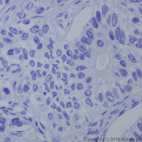 Immunohistochemistry (Formalin/PFA-fixed paraffin-embedded sections) - Anti-HNF-1B antibody [EPR18644-13] (AB213149)