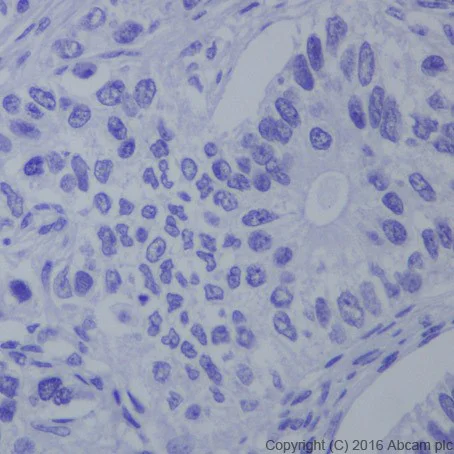 Immunohistochemistry (Formalin/PFA-fixed paraffin-embedded sections) - Anti-HNF-1B antibody [EPR18644-13] (AB213149)