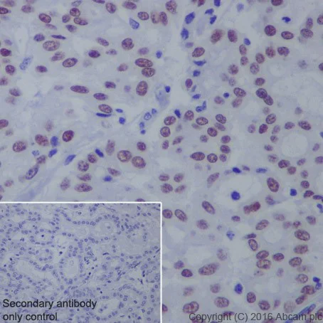 Immunohistochemistry (Formalin/PFA-fixed paraffin-embedded sections) - Anti-HNF-1B antibody [EPR18644-13] (AB213149)