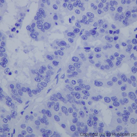 Immunohistochemistry (Formalin/PFA-fixed paraffin-embedded sections) - Anti-HNF-1B antibody [EPR18644-13] - BSA and Azide free (ab238980), expandable thumbnail
