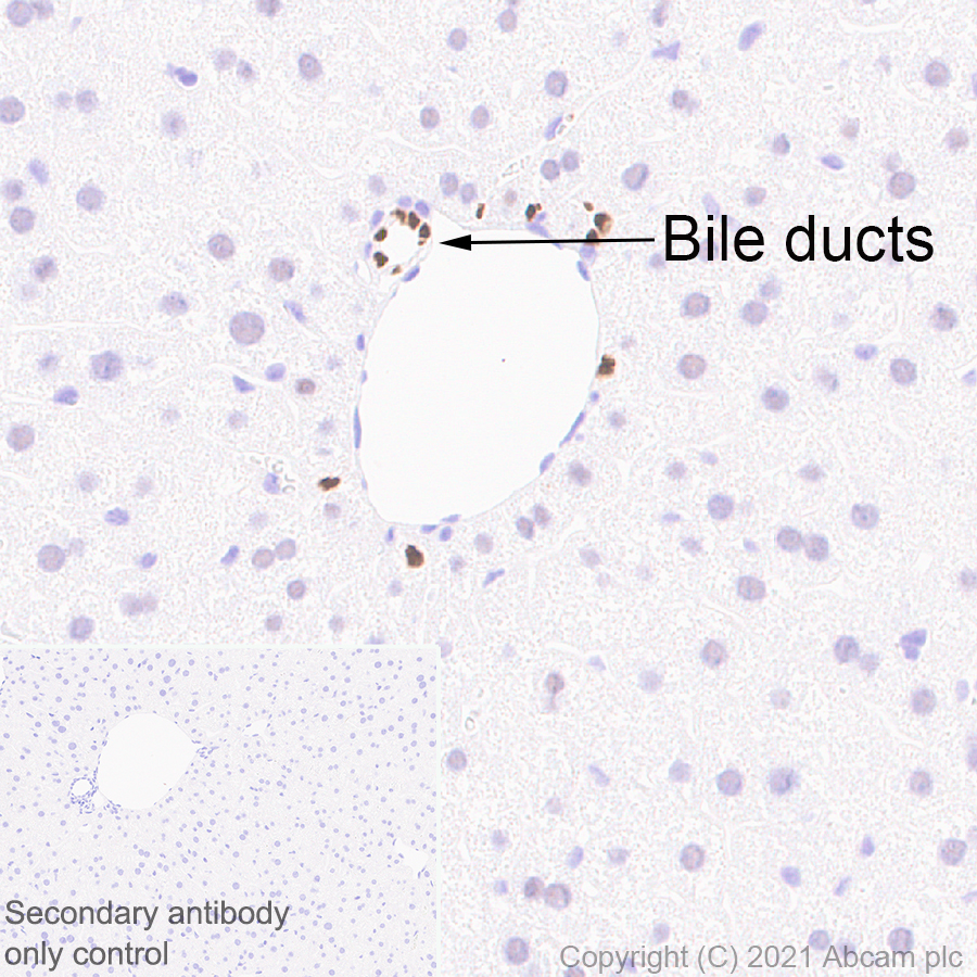 Immunohistochemistry (Formalin/PFA-fixed paraffin-embedded sections) - Anti-HNF-1B antibody [EPR18644-13] - BSA and Azide free (AB238980), expandable thumbnail