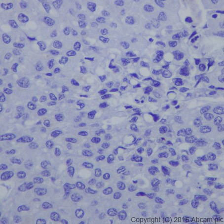 Immunohistochemistry (Formalin/PFA-fixed paraffin-embedded sections) - Anti-HNF-1B antibody [EPR18644-13] - BSA and Azide free (AB238980), expandable thumbnail