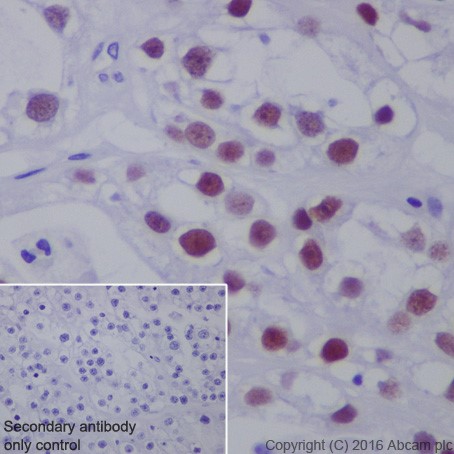 Immunohistochemistry (Formalin/PFA-fixed paraffin-embedded sections) - Anti-HNF-1B antibody [EPR18644-13] - BSA and Azide free (ab238980), expandable thumbnail