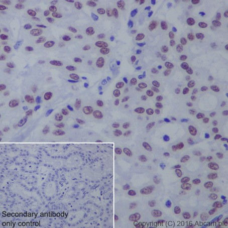 Immunohistochemistry (Formalin/PFA-fixed paraffin-embedded sections) - Anti-HNF-1B antibody [EPR18644-13] - BSA and Azide free (AB238980), expandable thumbnail
