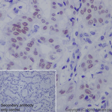 Immunohistochemistry (Formalin/PFA-fixed paraffin-embedded sections) - Anti-HNF-1B antibody [EPR18644-37] (AB213150)