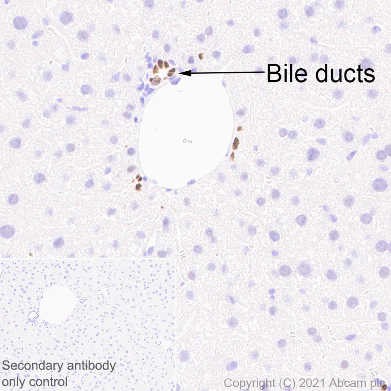 Immunohistochemistry (Formalin/PFA-fixed paraffin-embedded sections) - Anti-HNF-1B antibody [EPR18644-37] (AB213150)