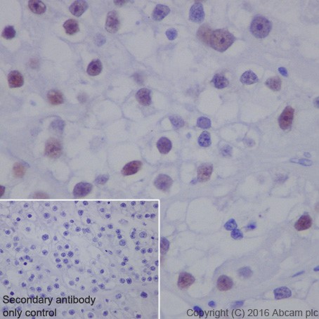 Immunohistochemistry (Formalin/PFA-fixed paraffin-embedded sections) - Anti-HNF-1B antibody [EPR18644-37] (AB213150)
