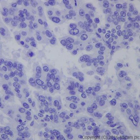 Immunohistochemistry (Formalin/PFA-fixed paraffin-embedded sections) - Anti-HNF-1B antibody [EPR18644-37] (AB213150)