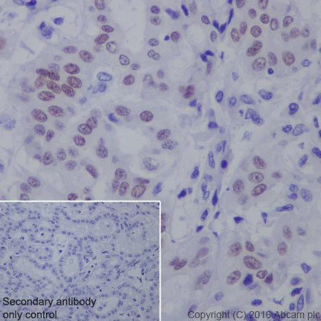 Immunohistochemistry (Formalin/PFA-fixed paraffin-embedded sections) - Anti-HNF-1B antibody [EPR18644-37] - BSA and Azide free (AB251538)