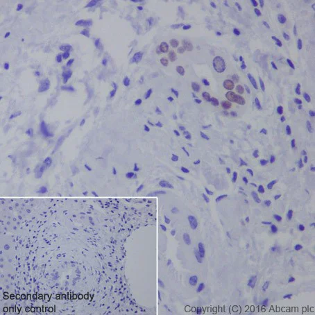 Immunohistochemistry (Formalin/PFA-fixed paraffin-embedded sections) - Anti-HNF-1B antibody [EPR18644-37] - BSA and Azide free (AB251538)