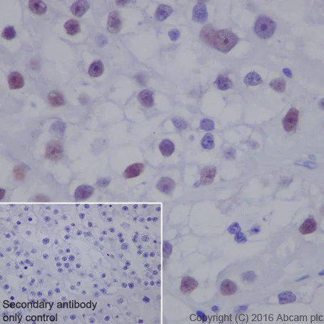 Immunohistochemistry (Formalin/PFA-fixed paraffin-embedded sections) - Anti-HNF-1B antibody [EPR18644-37] - BSA and Azide free (AB251538)