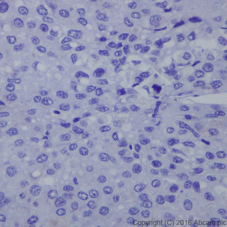 Immunohistochemistry (Formalin/PFA-fixed paraffin-embedded sections) - Anti-HNF-1B antibody [EPR18644-37] - BSA and Azide free (AB251538)
