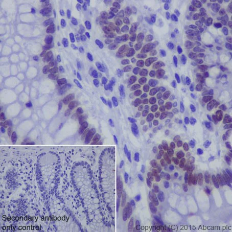 Immunohistochemistry (Formalin/PFA-fixed paraffin-embedded sections) - Anti-HNF-1B antibody [EPR18644] (AB209666)