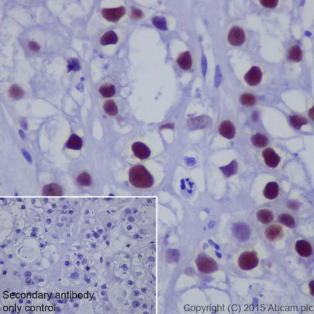 Immunohistochemistry (Formalin/PFA-fixed paraffin-embedded sections) - Anti-HNF-1B antibody [EPR18644] - BSA and Azide free (AB251510)