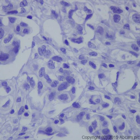Immunohistochemistry (Formalin/PFA-fixed paraffin-embedded sections) - Anti-HNF-1B antibody [EPR18644] - BSA and Azide free (AB251510)