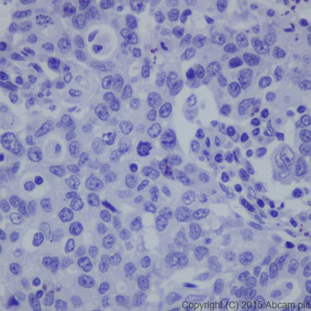 Immunohistochemistry (Formalin/PFA-fixed paraffin-embedded sections) - Anti-HNF-1B antibody [EPR18644] - BSA and Azide free (AB251510)