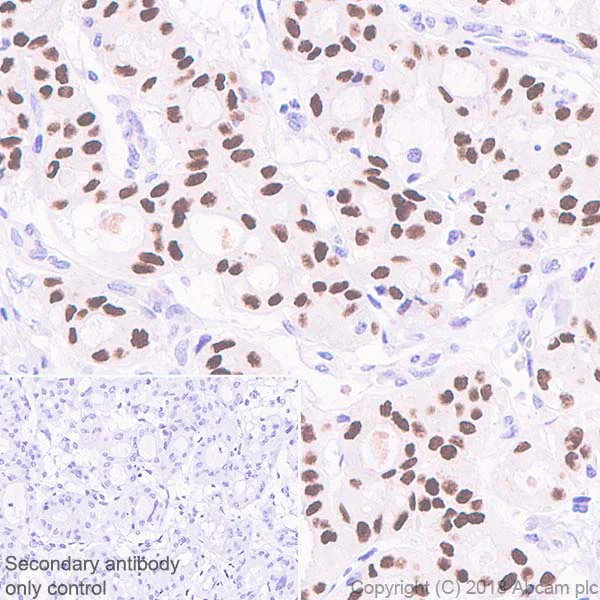 Immunohistochemistry (Formalin/PFA-fixed paraffin-embedded sections) - Anti-HNF-1B antibody [EPR18644] - BSA and Azide free (AB251510)