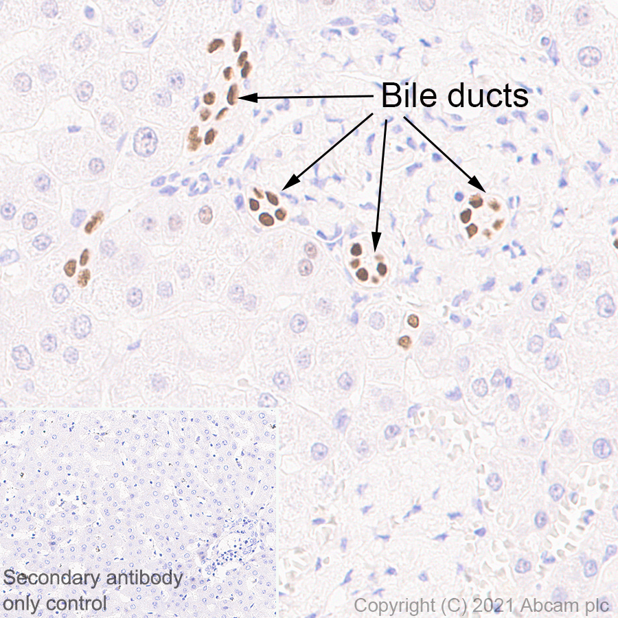 Immunohistochemistry (Formalin/PFA-fixed paraffin-embedded sections) - Anti-HNF-1B antibody [EPR6334(2)] (AB128912)