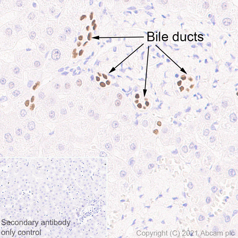Immunohistochemistry (Formalin/PFA-fixed paraffin-embedded sections) - Anti-HNF-1B antibody [EPR6334(2)] (AB128912)