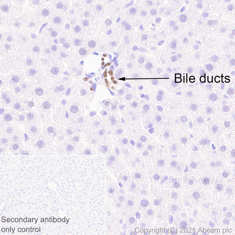 Immunohistochemistry (Formalin/PFA-fixed paraffin-embedded sections) - Anti-HNF-1B antibody [EPR6334(2)] (AB128912)