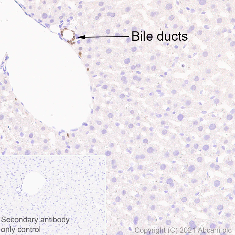 Immunohistochemistry (Formalin/PFA-fixed paraffin-embedded sections) - Anti-HNF-1B antibody [EPR6334(2)] (AB128912)