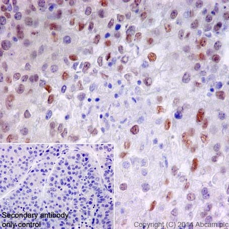 Immunohistochemistry (Formalin/PFA-fixed paraffin-embedded sections) - Anti-HNF-4-alpha antibody [EPR16787] (AB200654), expandable thumbnail