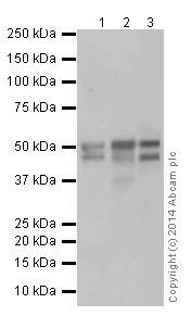 Western blot - Anti-HNF-4-alpha antibody [EPR16885] - ChIP Grade (AB181604)