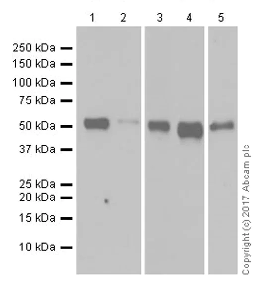 Western blot - Anti-HNF-4-alpha antibody [EPR19265-130] - ChIP Grade (AB200142)