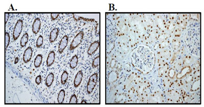 Immunohistochemistry (Formalin/PFA-fixed paraffin-embedded sections) - Anti-HNF-4-alpha antibody [EPR3648] - BSA and Azide free (AB227997), expandable thumbnail