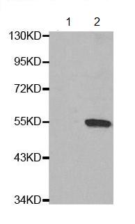 Western blot - Anti-HNF-4-alpha (phospho S304) antibody (AB194930)