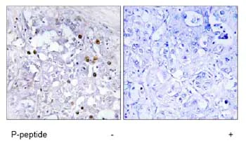 Immunohistochemistry (Formalin/PFA-fixed paraffin-embedded sections) - Anti-HNF-4-alpha (phospho S313) antibody (AB78356)