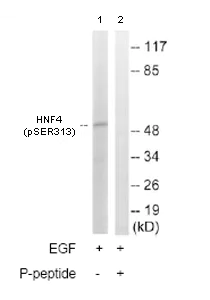 Western blot - Anti-HNF-4-alpha (phospho S313) antibody (AB78356)