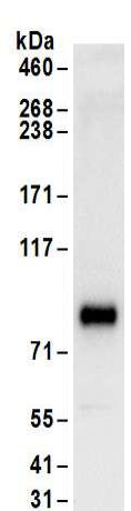 Immunoprecipitation - Anti-HNF1 alpha antibody (AB174653), expandable thumbnail