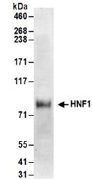 Western blot - Anti-HNF1 alpha antibody (AB174653), expandable thumbnail