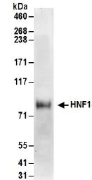 Western blot - Anti-HNF1 alpha antibody (AB174653)
